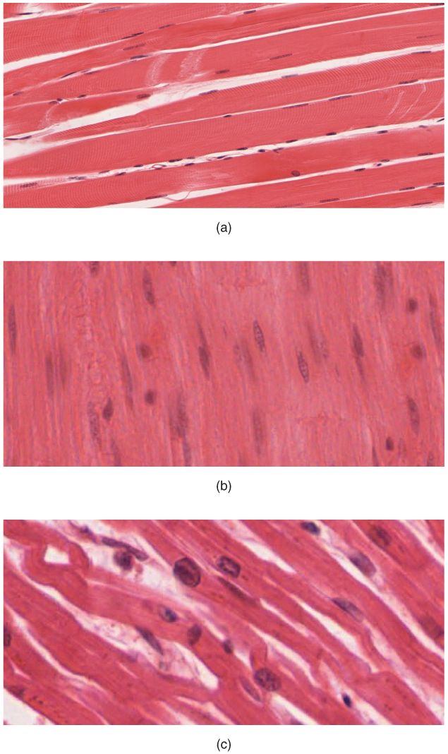 Skeletal, cardiac, and smooth muscle tissue side by side