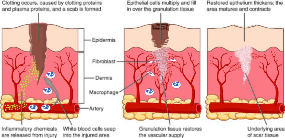 Diagram of the stages of wound healing
