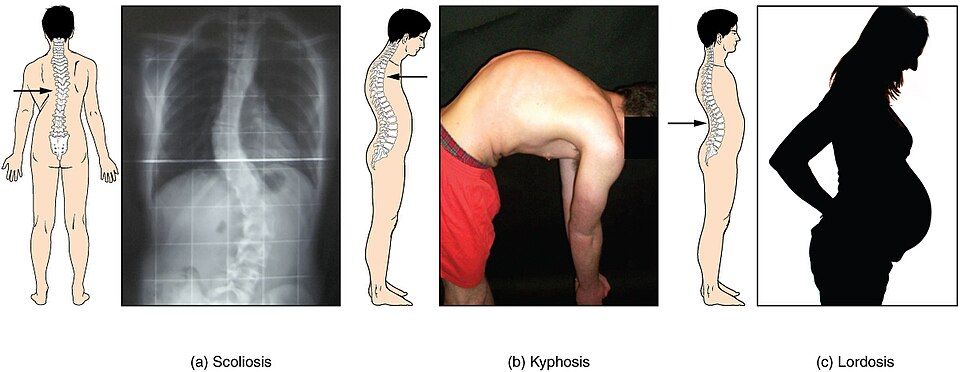 Spinal Curvatures reference figure