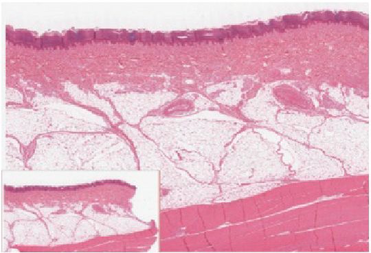 The five epidermal strata reference figure