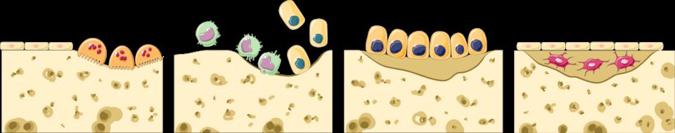 Bone cells and remodeling reference figure