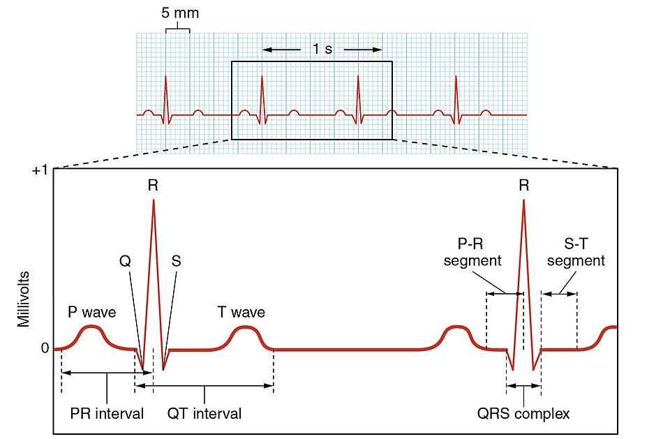 Normal electrocardiogram tracing reference figure