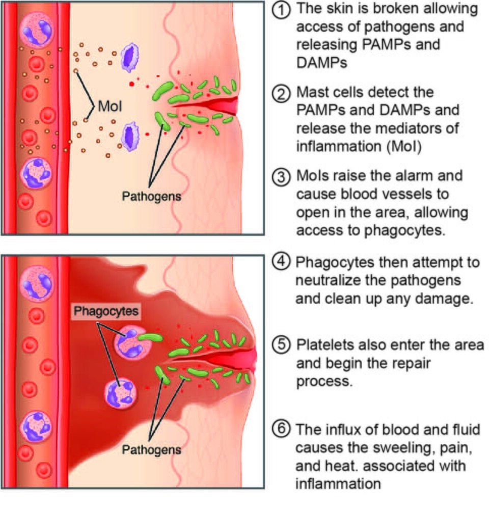 The inflammatory response reference figure