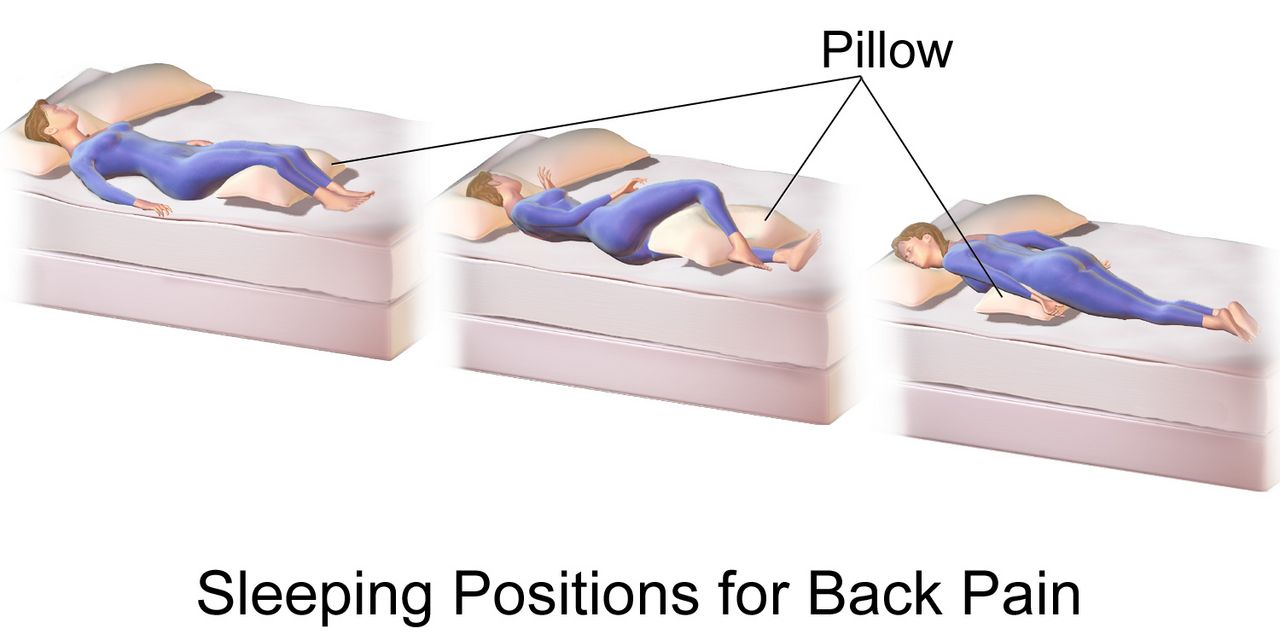 Diagram of common patient positions including supine, Fowler, semi-Fowler, side-lying, Sims and prone