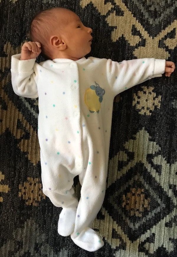 A newborn showing the asymmetrical tonic neck reflex, one arm extended toward the direction the head is turned