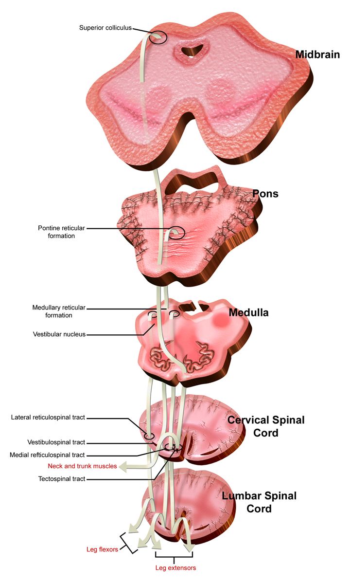 Illustration of umbilical cord prolapse showing the umbilical cord descending ahead of the fetal presenting part through the cervix