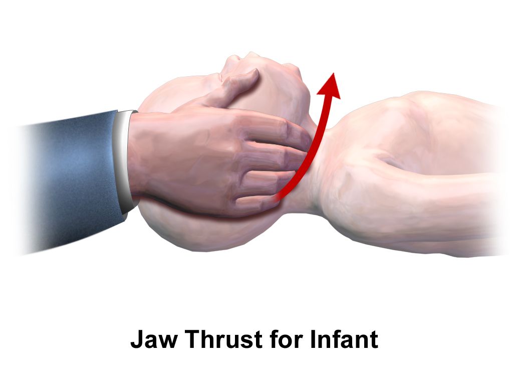 A nurse performing a neurological assessment on an infant, supporting the head while examining pupil response