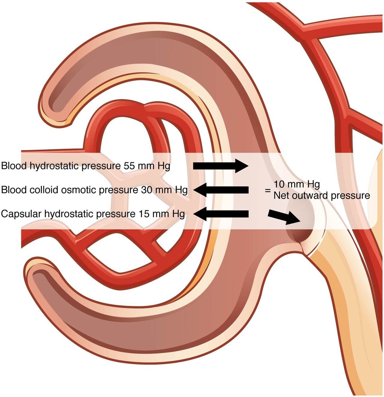 Chart of chronic kidney disease stages by estimated glomerular filtration rate alongside the systemic complications of uremia