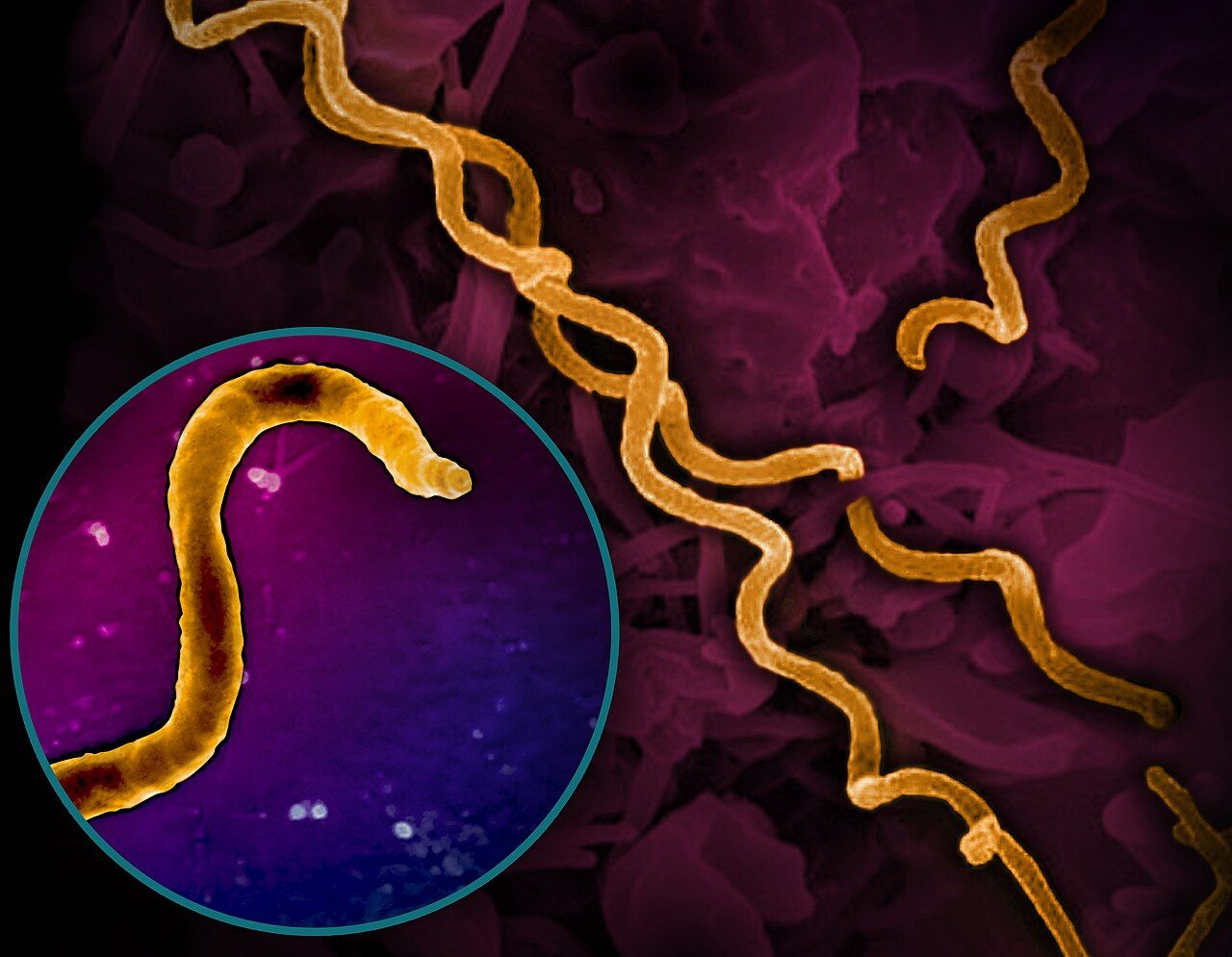 Treponema pallidum, the syphilis spirochete — an infection whose incidence, including congenital cases, has risen sharply in recent years.