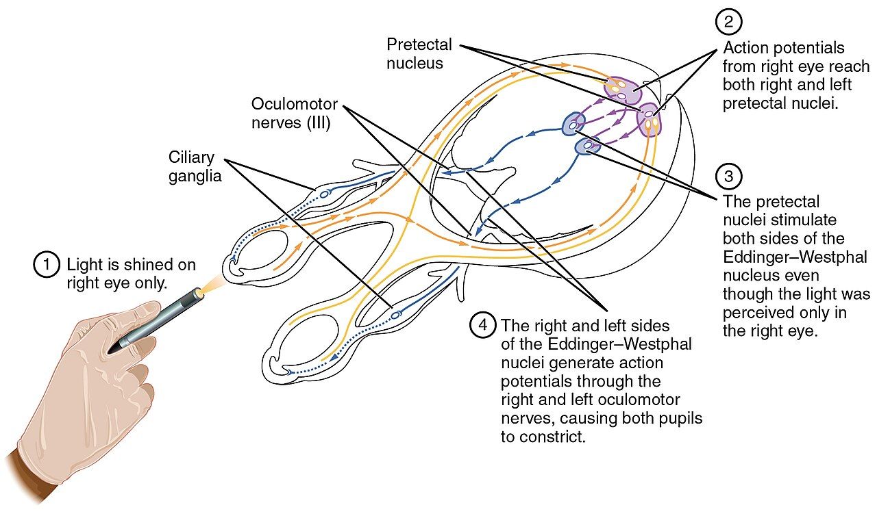 A nurse in an intensive care unit at the bedside of a ventilated patient, checking a pupillary light reflex with a penlight.