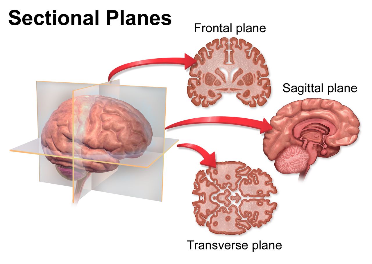 Human figure with three intersecting body planes shown: a vertical sagittal plane dividing right from left, a vertical frontal plane dividing front from back, and a horizontal transverse plane dividing upper from lower.