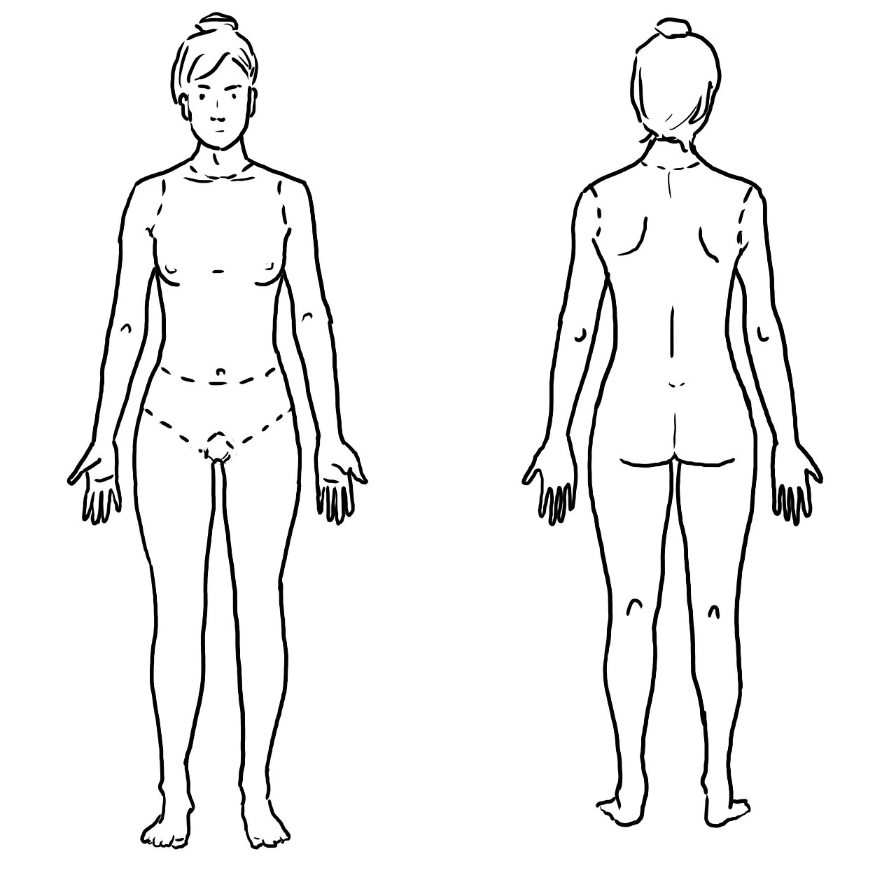 The rule of nines divides the adult body into multiples of nine percent so that burn extent can be charted as total body surface area.