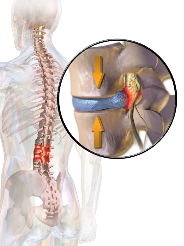 Illustration comparing fracture patterns including transverse, oblique, spiral, comminuted, greenstick, impacted, compression and open fractures