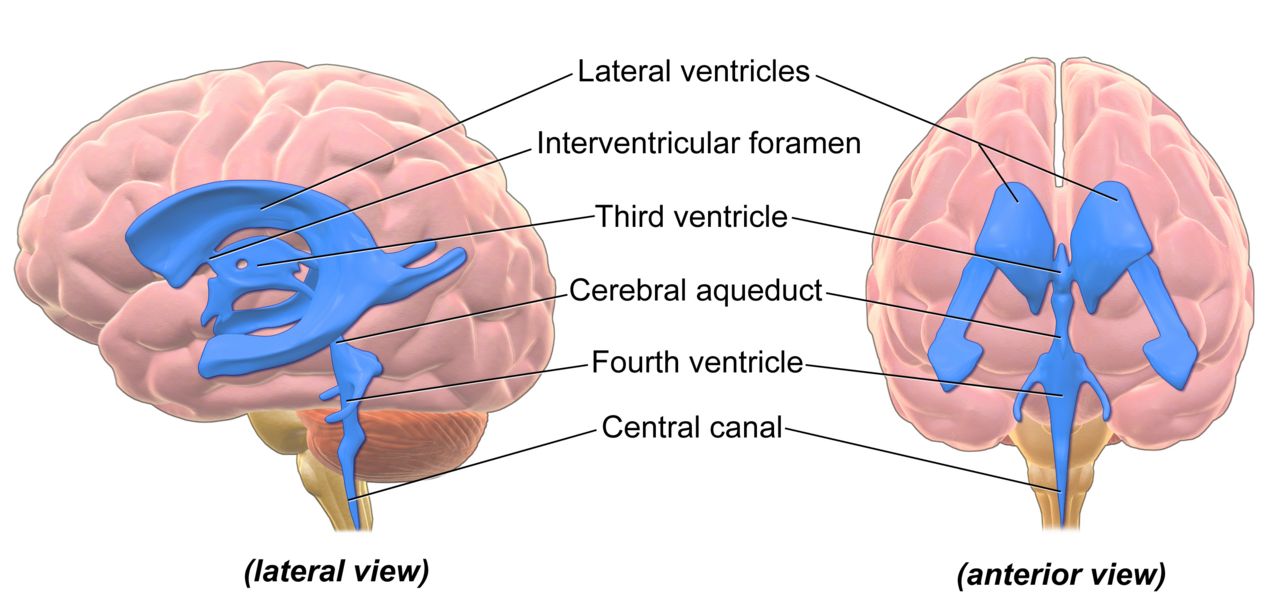 Side-by-side comparison of a healthy brain and a brain with advanced Alzheimer disease showing cortical atrophy and enlarged ventricles