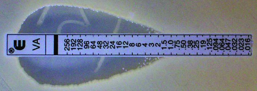 An Etest strip on an agar plate showing the minimum inhibitory concentration