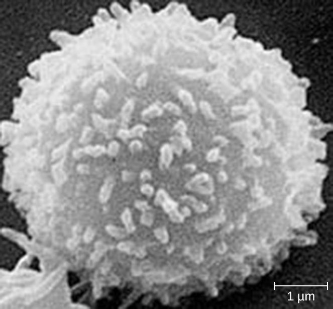 T lymphocyte recognizing antigen presented on an MHC molecule