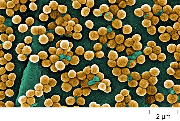 Staphylococcus aureus cells forming grape-like clusters