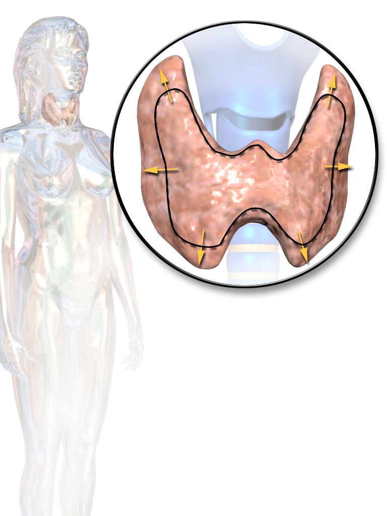 Thyroid disorders reference figure