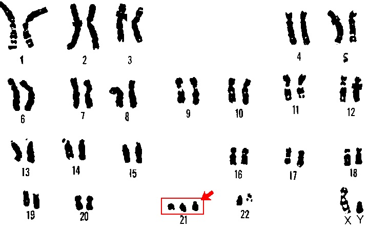 Chromosomal disorders reference figure