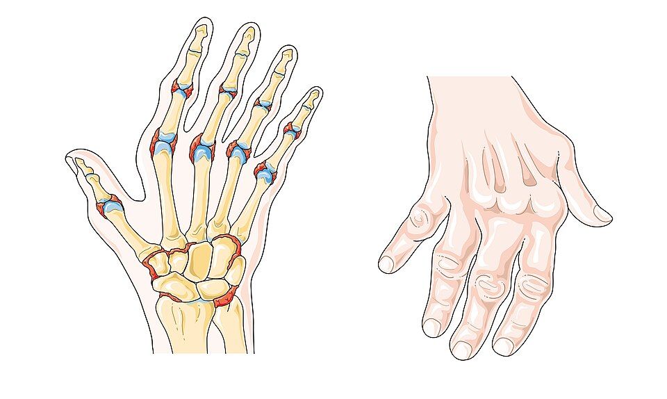 MSK disorders reference figure