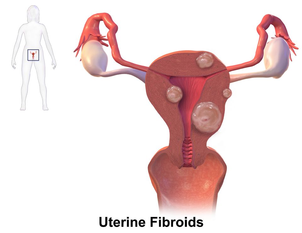 Female disorders reference figure
