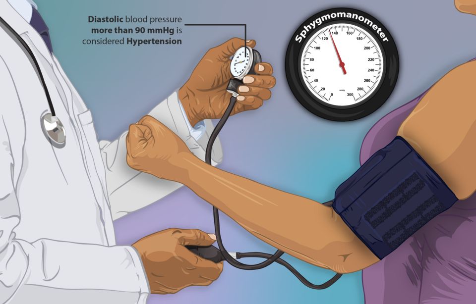 Reference figure for high blood pressure