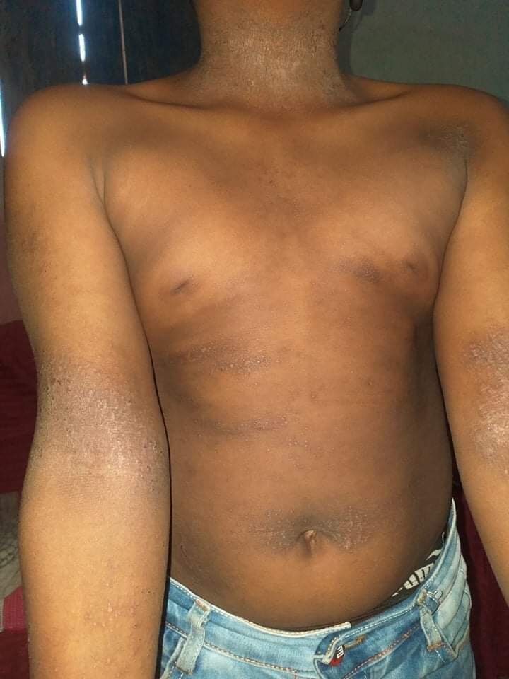 Reference figure on skin conditions