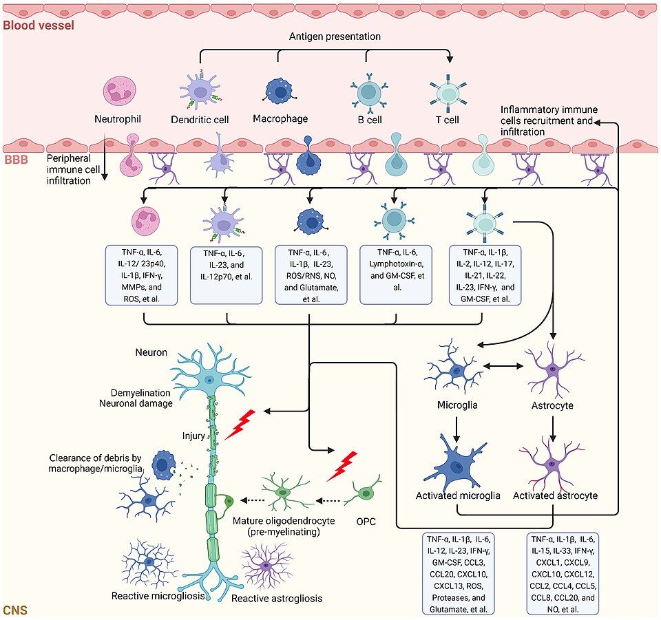 Reference figure for demyelinating disease
