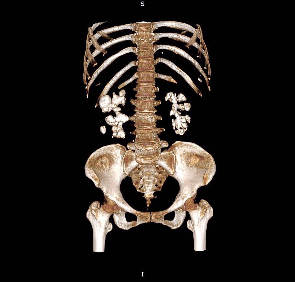 UTIs reference figure