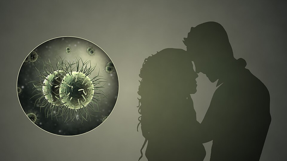 Diagram of common sexually transmitted infections and the organisms that cause them
