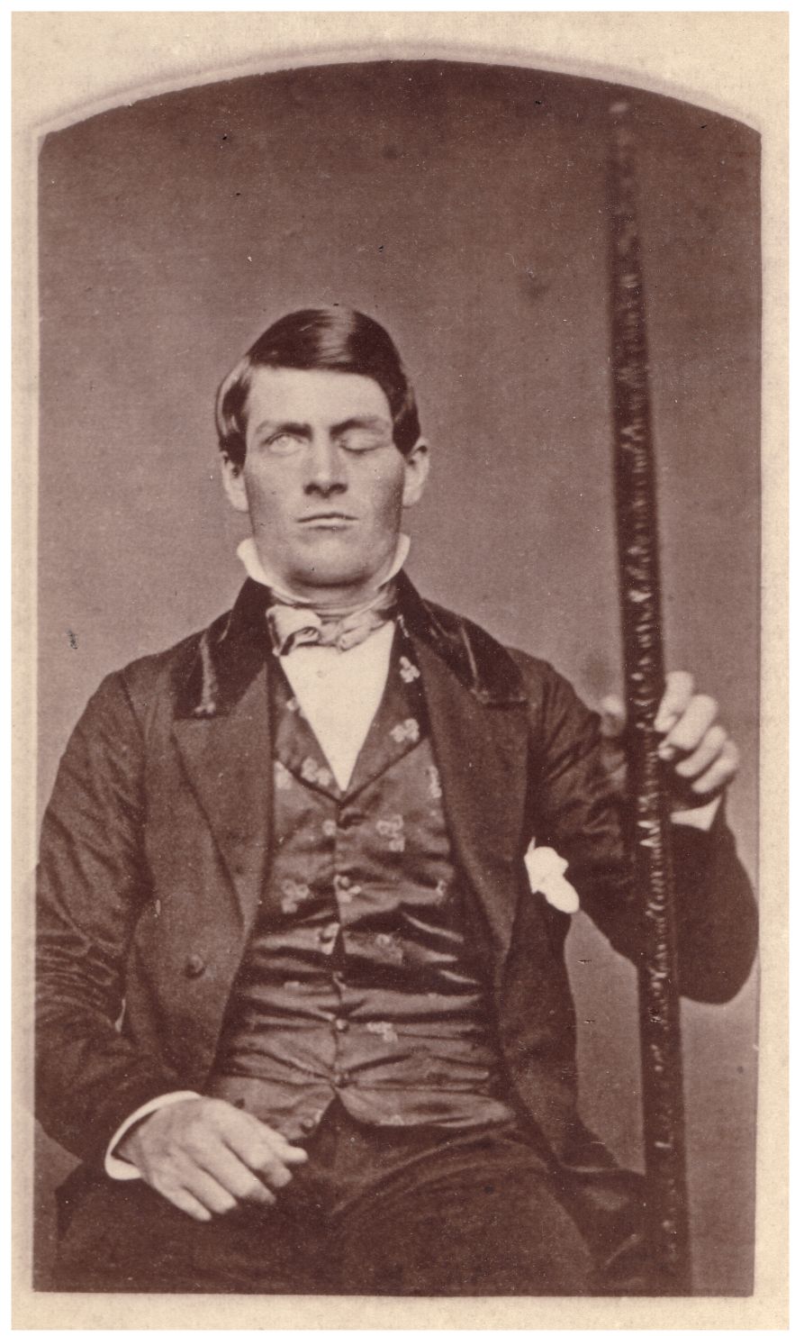 Portrait of Phineas Gage holding the tamping iron that passed through his skull