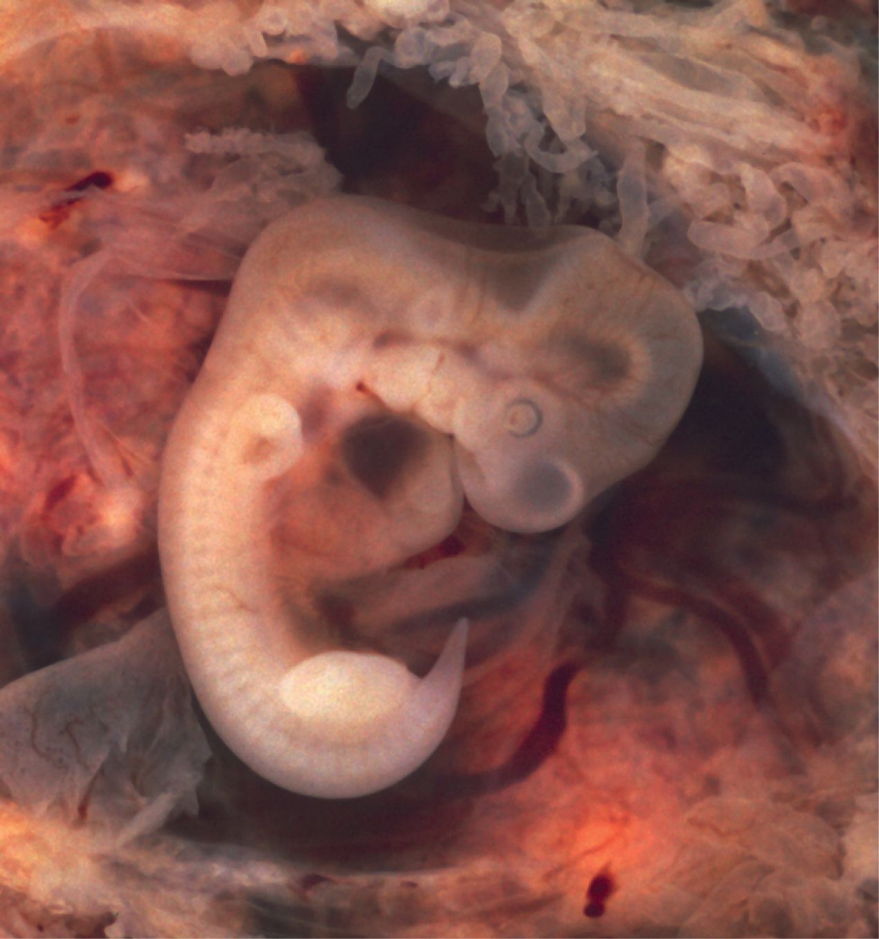 Photograph of a human embryo in early development